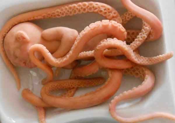 Crazy Baby Octo-Fetus