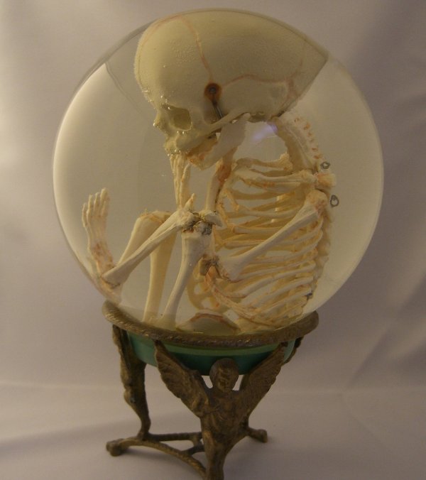 Human Fetal Skeleton In Glass Womb