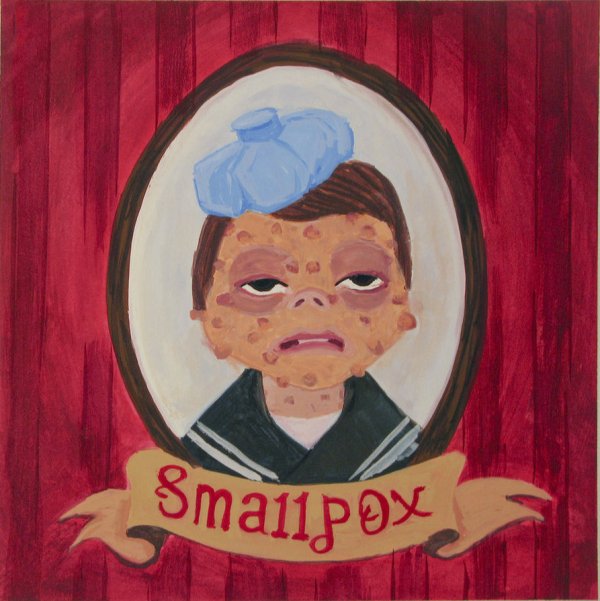 Goiter and Pox