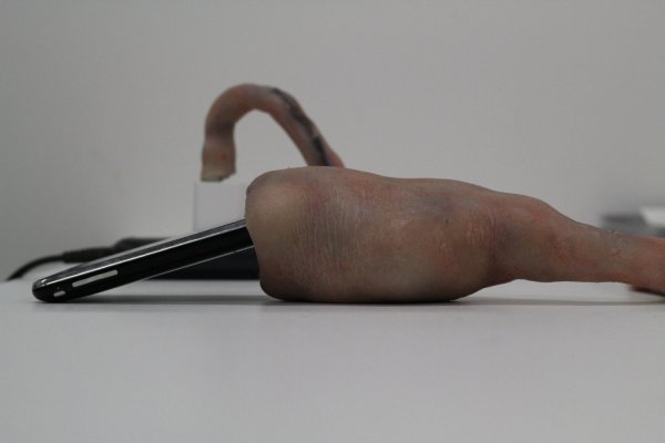 iPhone Umbilical Cord Helps You Stay Connected