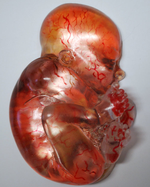 Clear Half Fetus For Your Wall