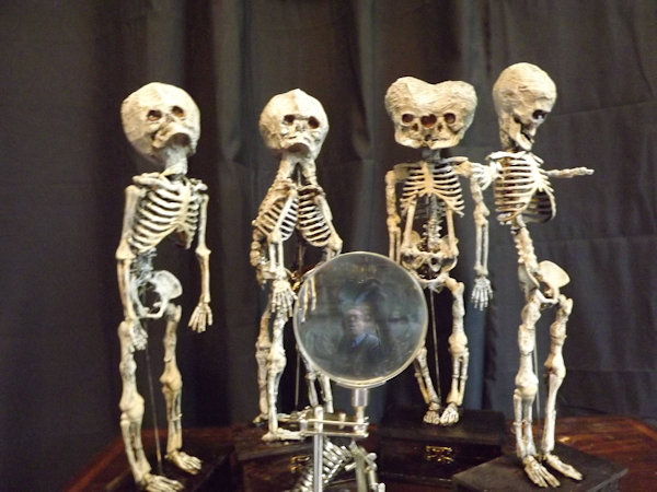 4 Malformed Fetal Skeleton Specimens